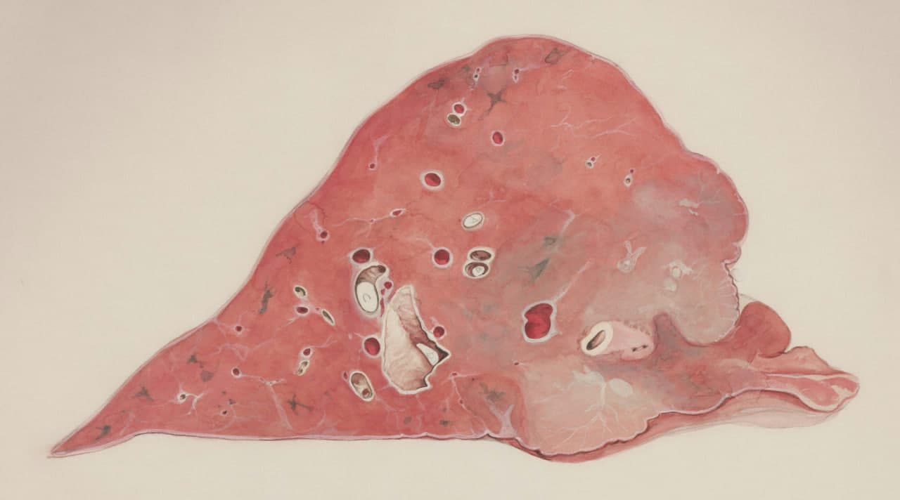 Liver disorders care